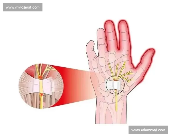 长期高强度操作导致电竞腕管综合征的危害与预防研究分析